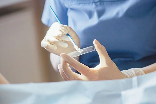 Hình ảnh tin tức Cách xác định bạn có nguy cơ mắc ung thư cổ tử cung không?