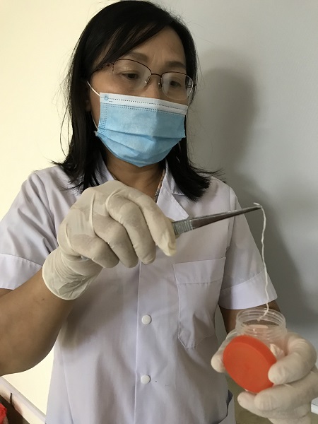 Hay ăn gỏi cá, giun rồng ký sinh trong đùi người đàn ông